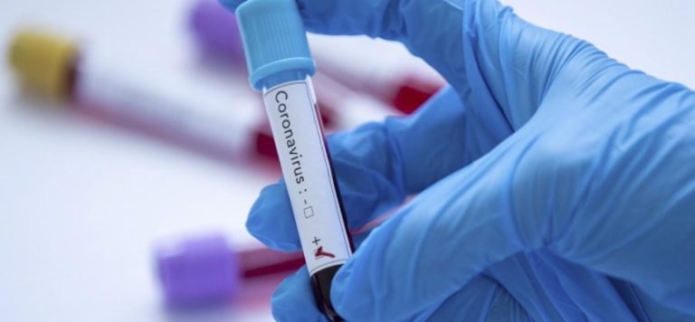 Paralimpik Oyunları’nda vaka sayısı 230’a çıktı