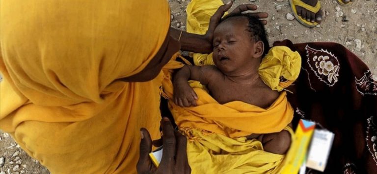 Dünya genelinde 35 milyon insan açlıktan ölüyor veya ölmek üzere